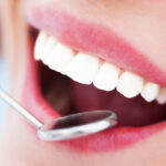 Cosmetic Dental Treatments That Can Leave You Feeling More Confident